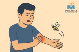 Sưng đỏ và đau tại chỗ là phản ứng thông thường khi bị ong đốt.